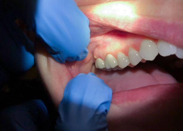 Best Emergency Cosmetic Dentistry in Phoenix Lake, CA