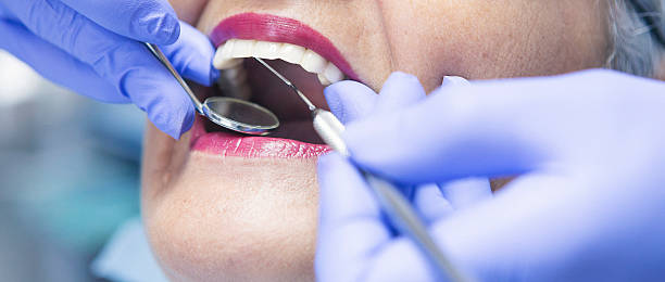 Best Emergency Dental Extractions in Phoenix Lake, CA