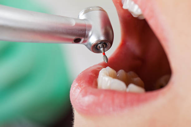 Best Emergency Dentist for Special Needs Patients in Phoenix Lake, CA